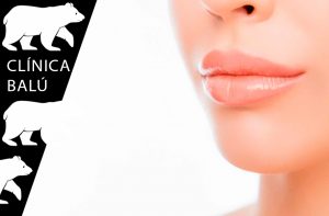 acido hialuronico labios inflamados