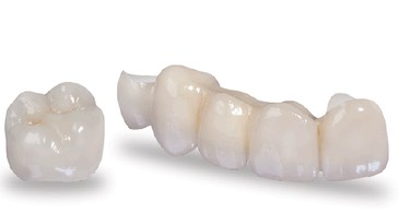 Fundas de circonio en Clínica dental Balú