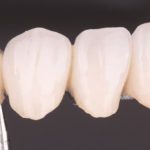 Fundas dentales